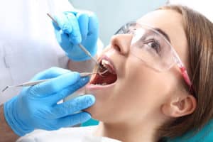 Root  Canals